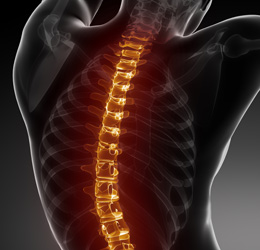 Spinal Cord Injury